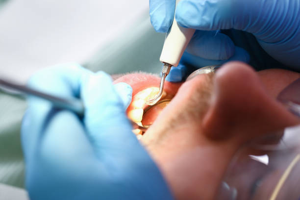Best After-Hours Emergency Dentist in Glenpool, OK