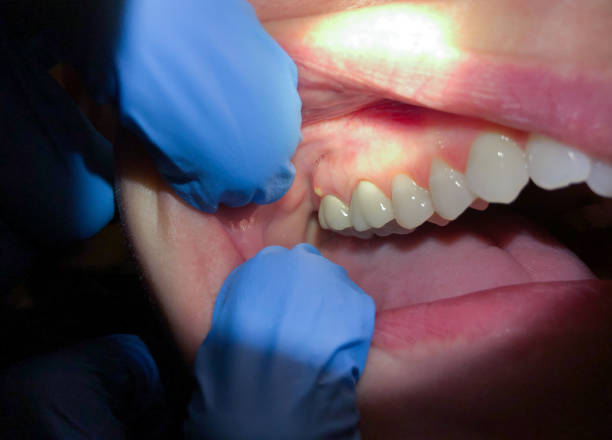 Best Walk-In Emergency Dentist in Glenpool, OK