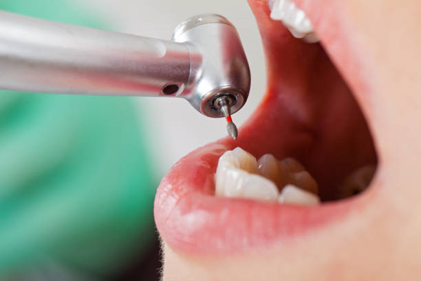 Best Emergency Dental Surgery in Glenpool, OK